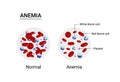 Vector illustration of the difference of number of healthy red blood cells. Anemia and normal